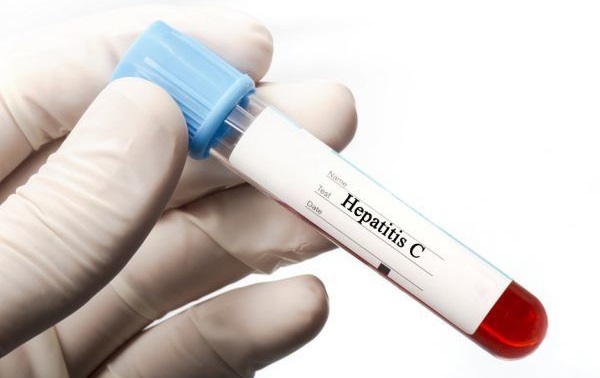 Анализ на антитела гепатита С