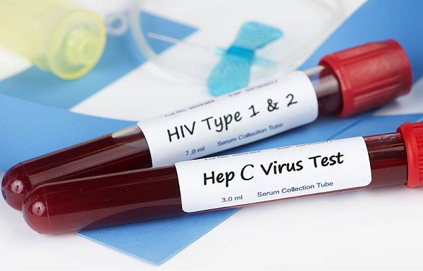ВИЧ и гепатит фото